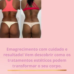 Mary Nardelle Estetica em Vargem Grande Podologia e Depilação