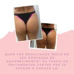 Mary Nardelle Estetica em Vargem Grande Podologia e Depilação
